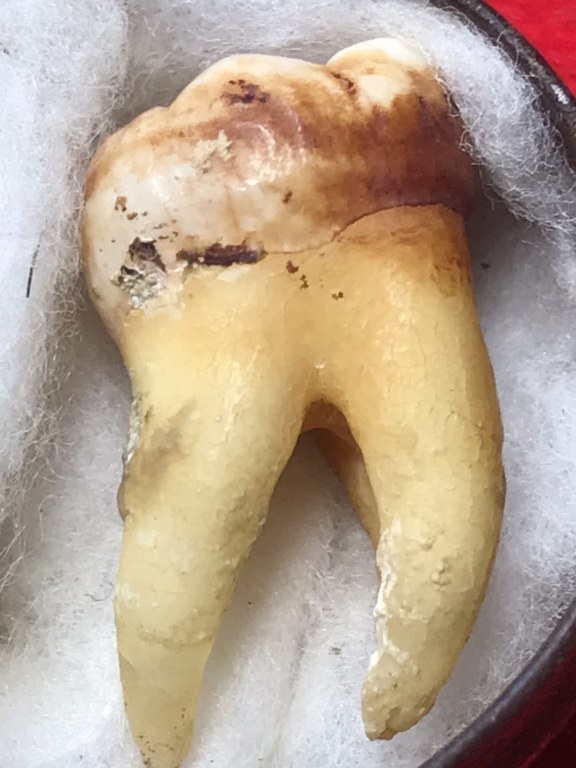 พระทันตธาตุ ครูบาบุญมา วัดแม่สะลาบ จ.เชียงใหม่ ได้มาจากกำนันคำ ซึ่งได้พระทันตธาตุชุดนี้มาจากเพื่อนชื่อเดช อ.สารภี คุณเดช เคยค้าขายข้าวกับท่านกำนันคำ ปัจจุบันเสียชีวิตแล้ว คุณเดช เป็นคนเล่นพระ ให้เช่าบูชาพระในสมัยนั้นด้วย และเป็นศิษย์รับใช้ครูบาบุญมา