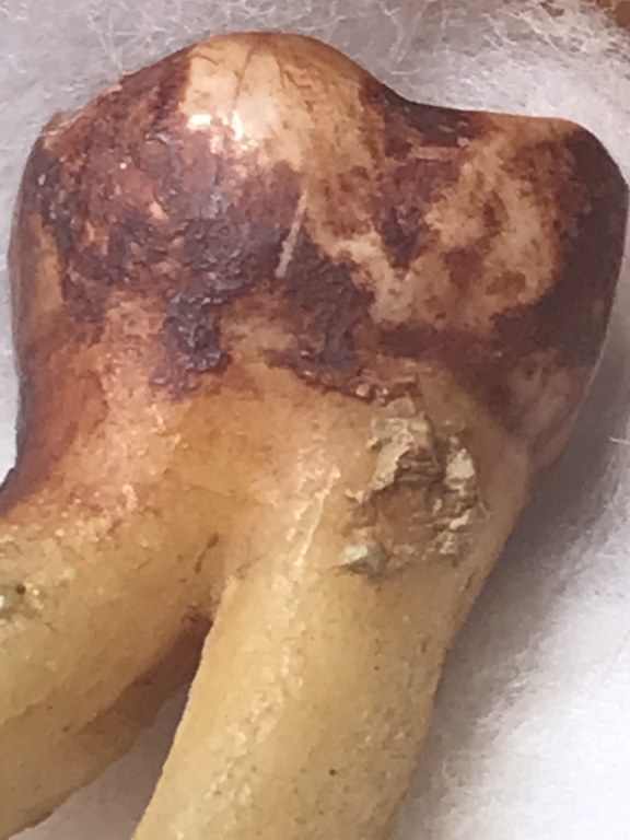 พระทันตธาตุ ครูบาใจมา วัดทุ่งจำลอง ต.แม่งอน อ.ฝาง จ.เชียงใหม่ องค์นี้ได้มาจากคุณลุงสันติ อายุ 79 ปี เป็นชาว อ.ฝาง จ.เชียงใหม่ คุณลุงสันติ เคยบวชเป็นพระ รับใช้ครูบาใจมา ตั้งแต่ปี พ.ศ. 2532-2540 ท่านสึกมาเมื่อปี 2541 มาดูสวนส้ม และดูแลคุณแม่