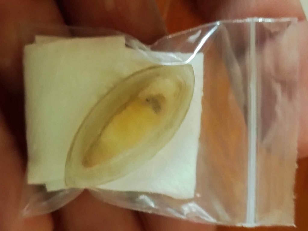 พระทันตธาตุ ครูบาปัน วัดหนองจาง ต.เมืองจี้ อ.เมือง จ.ลำพูน ได้จากครูวินัย ท่านเคยสอนที่โรงเรียนบ้านแป้น ปัจจุบันอายุ 72 ปี ท่านได้พระทันตธาตุนี้มาจากหลานครูบาปัน ชื่อปู่คำ ปู่คำท่านเสียชีวิตเมื่อ พ.ศ. 2550 ตอนอายุ 80 ปี ได้พระทันตธาตุมาเมื่อปี 2519