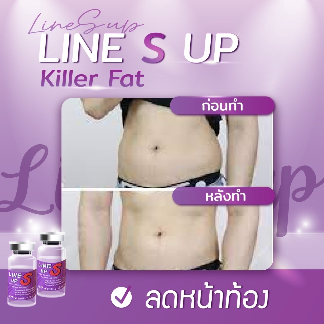 Line S Up / (1 ขวด)