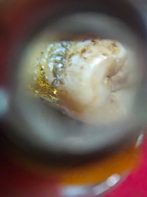 พระทันตธาตุ ครูบาสิทธิ วัดปางต้นเดื่อ อ.แม่อาย จ.เชียงใหม่ เจ้าของเดิมชื่อคุณบอม เคยเป็นเภสัชโรงพยาบาลสันทราย จ.เชียงใหม่ ปัจจุบันอายุ 47 ปี (บันทึก พ.ศ.2566) เคยเป็นศิษย์และนับถือครูบาสิทธิตั้งแต่ปี 2549 - 2555 จนครูบาสิทธิท่านมรณภาพ