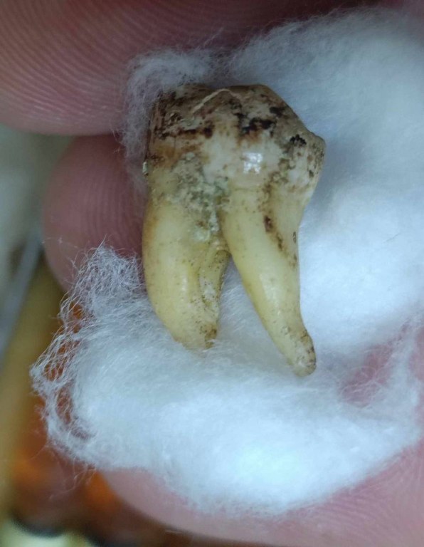 พระทันตธาตุครูบาคำแสน วัดป่าดอนมูล จ.เชียงใหม่ ได้มาจากกำนันคำ อดีตกำนันบ้านปากกอง อ.สารภี จ.เชียงใหม่ ปัจจุบันอายุ 86 ปี กำนันคำจะมีคนคอยหาวัตถุมงคลให้ ชื่อว่าลุงสมควร ปัจจุบันเสียชีวิตแล้ว ถ้ามีชีวิตอยู่ถึงปัจจุบันน่าจะมีอายุประมาณ 70 ปี