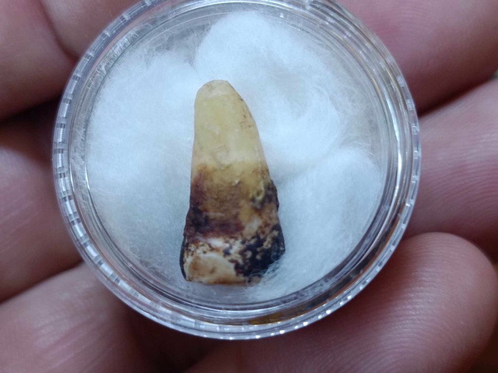 พระทันตธาตุ พระเกศา ครูบาสุนทร วัดป่าป่วย อ.บ้านโฮ่ง จ.ลำพูน เจ้าของเดิม ชื่อคำแสน อดีตผู้ใหญ่บ้าน บ้านสันตับเต่า อ.บ้านโฮ่ง จ.ลำพูน บ้านลุงคำแสนอยู่ห่างจากวัดไม่มาก อายุ 74 ปี (บันทึก พ.ศ. 2567) ท่านจำได้แต่ว่าได้มาหลายสิบปีแล้ว แต่จำ พ.ศ.ไม่ได้