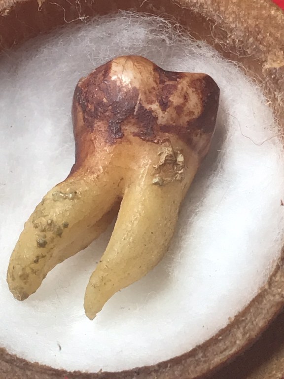 พระทันตธาตุ ครูบาใจมา วัดทุ่งจำลอง ต.แม่งอน อ.ฝาง จ.เชียงใหม่ องค์นี้ได้มาจากคุณลุงสันติ อายุ 79 ปี เป็นชาว อ.ฝาง จ.เชียงใหม่ คุณลุงสันติ เคยบวชเป็นพระ รับใช้ครูบาใจมา ตั้งแต่ปี พ.ศ. 2532-2540 ท่านสึกมาเมื่อปี 2541 มาดูสวนส้ม และดูแลคุณแม่