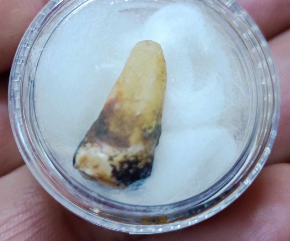 พระทันตธาตุ พระเกศา ครูบาสุนทร วัดป่าป่วย อ.บ้านโฮ่ง จ.ลำพูน เจ้าของเดิม ชื่อคำแสน อดีตผู้ใหญ่บ้าน บ้านสันตับเต่า อ.บ้านโฮ่ง จ.ลำพูน บ้านลุงคำแสนอยู่ห่างจากวัดไม่มาก อายุ 74 ปี (บันทึก พ.ศ. 2567) ท่านจำได้แต่ว่าได้มาหลายสิบปีแล้ว แต่จำ พ.ศ.ไม่ได้