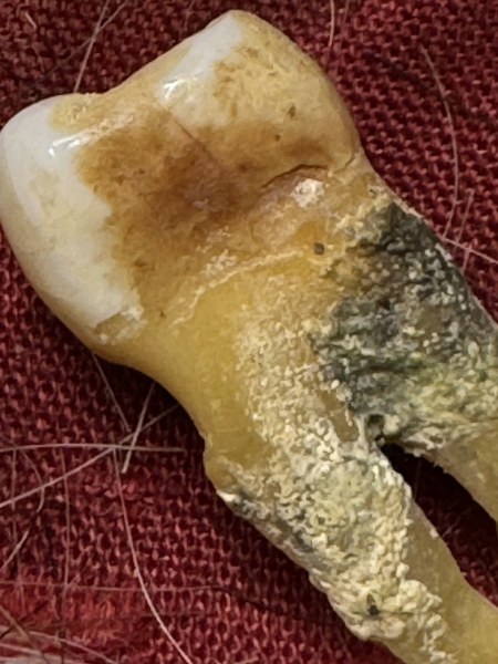 พระทันตธาตุ ครูบาศรียูร วัดมงคล จ. เชียงใหม่ ร.ต.อ.พิทักษ์ ได้มาจากครุวินัย อดีตเคยสอนในโรงเรียนจอมทอง อ.จอมทอง จ.เชียงใหม่ อายุกว่า 60 ปี ครูวินัยเป็นคน อ.สันป่าตอง เป็นลูกศิษย์ครูบาศรียูร ได้พระทันตธาตุนี้มาเมื่อ ปี 2555