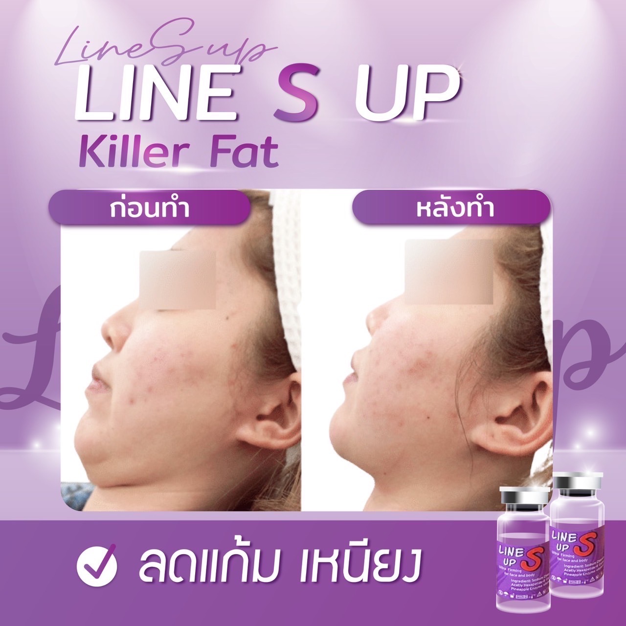 Line S Up / (1 ขวด)
