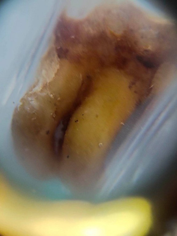 พระทันตธาตุ และรูปถ่ายบูชา ครูบาคำปัน ปภากโร (พระครูรัตนประภากร) วัดนาแส่ง ต.นาแส่ง อ.เกาะคา จ.ลำปาง เจ้าของชื่อ ลุงมูล อายุ 78 ปี ทำอาชีพขายของชำใน อ.ในเมือง จ.ลำปาง คุณลุงมูลเก็บวัตถุมงคลของครูบาคำปันไว้เยอะ โดยพระทันตธาตุนี้ได้มาเมื่อปี 2548