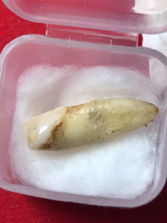 พระทันตธาตุครูบาอินทร์คำ วัดไชยสถาน อ.สารภี จ.เชียงใหม่ ได้มาจากพ่อหลวงชา ปัจจุบันอายุ 68 ปี (บันทึก พ.ศ.2566) อดีตผู้ใหญ่บ้าน ใน อ.แม่แตง จ.เชียงใหม่ พ่อหลวงชาเล่าว่าได้มาจากพ่อหนานทา อายุ 74 ปี เมื่อปี 2553