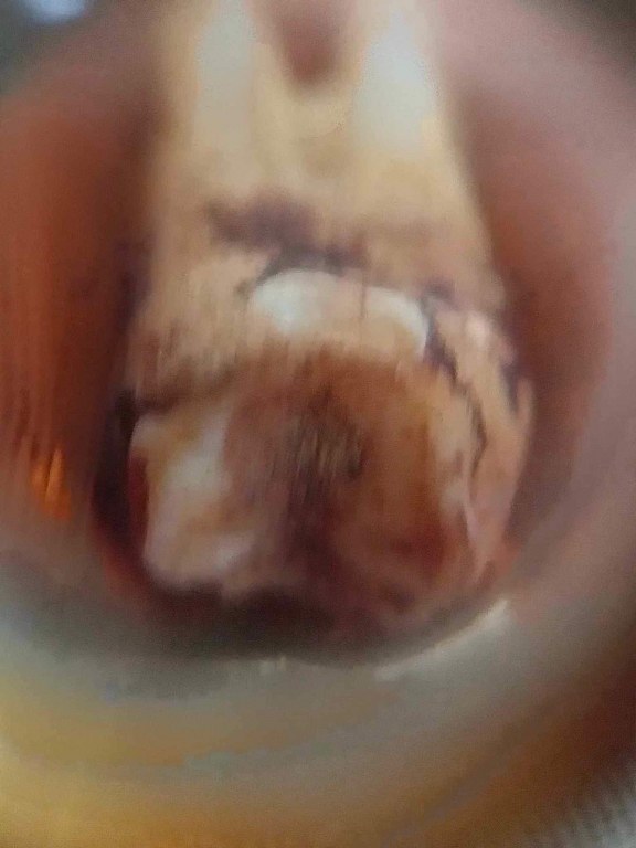 พระทันตธาตุครูบาแสง วัดร่องช้าง จ.ลำพูน ได้มาจากลุงประสิทธิ์ อดีตนายอำเภอ เวียงหนองล่อง อายุ 74 ปี เล่าว่าได้มา เมื่อสมัยที่ท่านเป็นปลัดอำเภอ อ.ป่าซาง เมื่อปี 2532 ได้จากผู้ช่วยผู้ใหญ่บ้านใน อ.ป่าซาง ซื่อว่าวิโรจน์ซึ่งมีศักดิ์เป็นหลานครูบาแสง