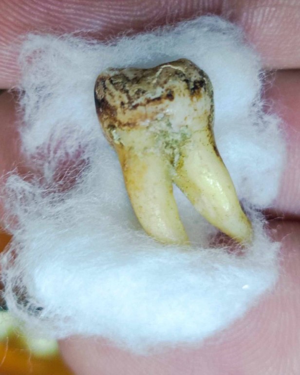 พระทันตธาตุครูบาคำแสน วัดป่าดอนมูล จ.เชียงใหม่ ได้มาจากกำนันคำ อดีตกำนันบ้านปากกอง อ.สารภี จ.เชียงใหม่ ปัจจุบันอายุ 86 ปี กำนันคำจะมีคนคอยหาวัตถุมงคลให้ ชื่อว่าลุงสมควร ปัจจุบันเสียชีวิตแล้ว ถ้ามีชีวิตอยู่ถึงปัจจุบันน่าจะมีอายุประมาณ 70 ปี