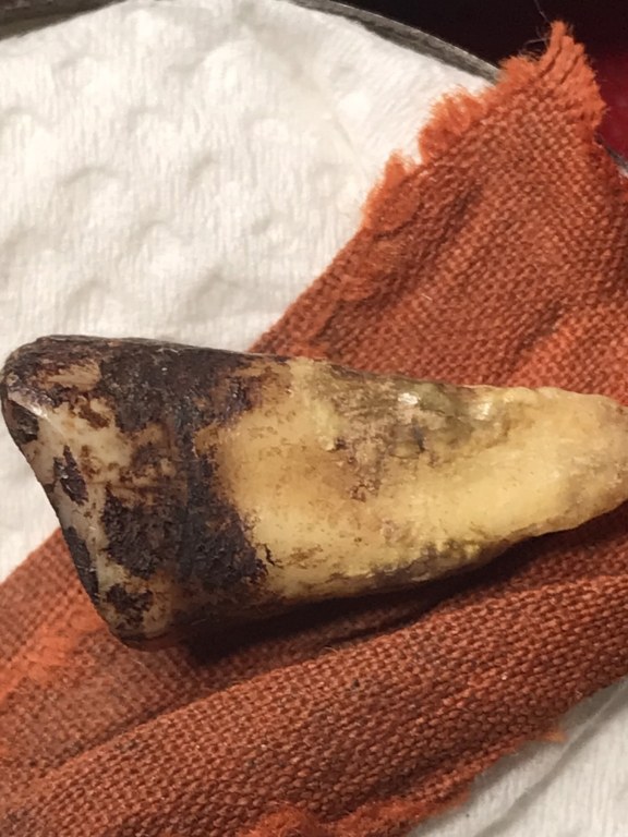 พระทันตธาตุครูบาสองเมือง วัดหล่ายแก้ว อ.บ้านโฮ่ง จ.ลำพูน พระอนันต์ เป็นศิษย์ครูบาสองเมือง ท่านสิ้นชีวิตแล้วเมื่อปี 2539 หากมีชีวิตอยู่ปัจจุบันจะมีอายุ 88 ปี (บันทึก พ.ศ.2566) ได้มอบให้ สจ.บอย อายุ 48 ปี อยู่หมู่บ้านเรือน อ.ป่าซาง จ.ลำพูน