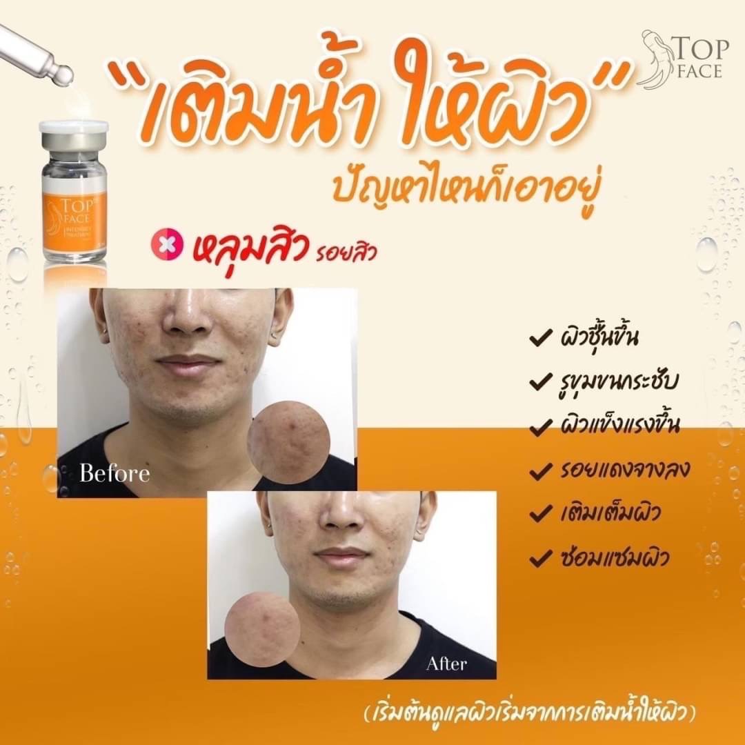 TOP FACE / (1 กล่อง / 8 ขวด)