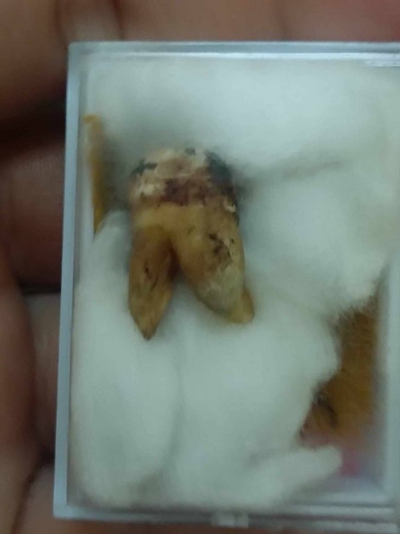 พระทันตธาตุ และผ้ายันต์เมตตา ค้าขายดี ครูบาจันต๊ะ วัดหนองช้างคืน จ.ลำพูน เจ้าของเดิมชื่อลุงวิทย์ เมื่อก่อนอาศัยอยู่ข้าง ๆ วัดหนองช้างคืน เป็นลูกศิษย์ยุคต้น ๆ รับใช้ครูบามา 6-7 ปี ระหว่างปี 2538 - 2545 ปัจจุบันอายุ 73 ปี