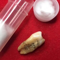 พระทันตธาตุ ครูบาติ๊บ วัดท่าวังพร้าว อ.สันป่าตอง จ.เชียงใหม่ ได้มาจากกำนันคำ อดีตกำนันบ้านปากกอง อ.สารภี จ.เชียงใหม่ ปัจจุบันอายุ 86 ปี (บันทึก พ.ศ.2566) กำนันคำได้พระทันตธาตุครูบาติ๊บ ได้มาเมื่อปี พ.ศ.2549 ได้มาจากลูกศิษย์ครูบาติ๊บ ชื่อลุงวิโรจน์