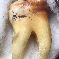 พระทันตธาตุ ครูบาบุญมา วัดแม่สะลาบ จ.เชียงใหม่ ได้มาจากกำนันคำ ซึ่งได้พระทันตธาตุชุดนี้มาจากเพื่อนชื่อเดช อ.สารภี คุณเดช เคยค้าขายข้าวกับท่านกำนันคำ ปัจจุบันเสียชีวิตแล้ว คุณเดช เป็นคนเล่นพระ ให้เช่าบูชาพระในสมัยนั้นด้วย และเป็นศิษย์รับใช้ครูบาบุญมา