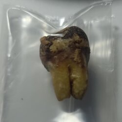 พระทันตธาตุ หลวงปู่ชา วัดหนองป่าพง จ.อุบลราชธานี ลุงนิดได้รับมาจากพระวินัย ในปี 2566 ตอนที่ลุงนิดได้รู้จักพระวินัยกำลังเดินธุดงผ่านมาทางอำเภอแม่ริม จ.เชียงใหม่ ได้รู้จักศรัทธาในพระวินัย ได้นับถือตามไปส่งพระวินัยในจังหวัดเชียงใหม่ อำเภอแม่แตง แม่ริม