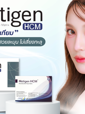 Matigen HCM เนื้อเยื่อเทียมจากคอลลาเจน เสริมจมูกสำหรับคนเนื้อน้อย